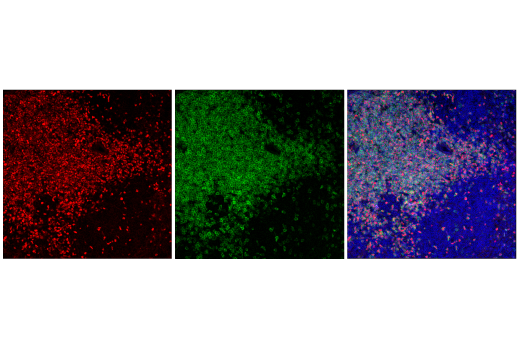 Immunofluorescence Image 1: TCF1/TCF7 (E6O1K) Rabbit mAb (Alexa Fluor® 594 Conjugate)