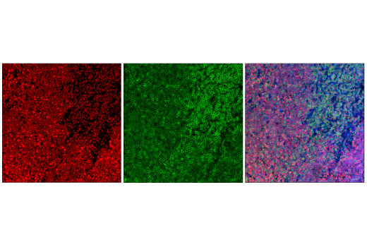 Immunofluorescence Image 2: TCF1/TCF7 (E6O1K) Rabbit mAb (Alexa Fluor® 594 Conjugate)