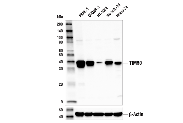 Western Blotting Image 1: TIM50 Antibody