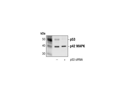  Image 1: SignalSilence® p53 siRNA I