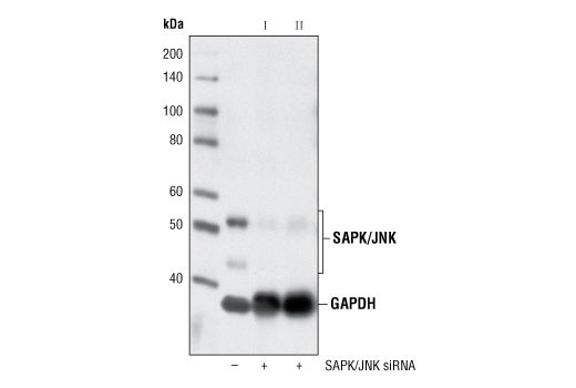  Image 1: SignalSilence® SAPK/JNK siRNA I