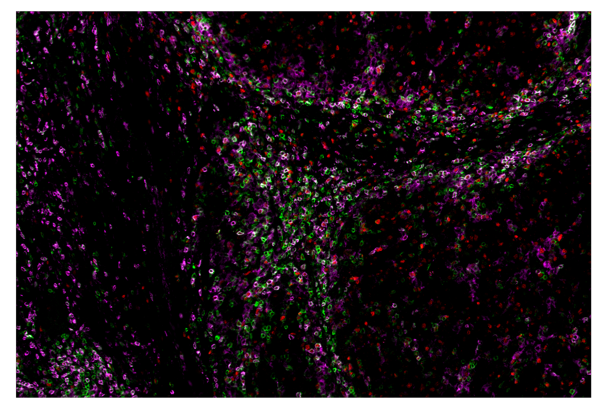 Immunohistochemistry Image 8: CD4 (MSVA-004R) & CO-0071-488 SignalStar™ Oligo-Antibody Pair