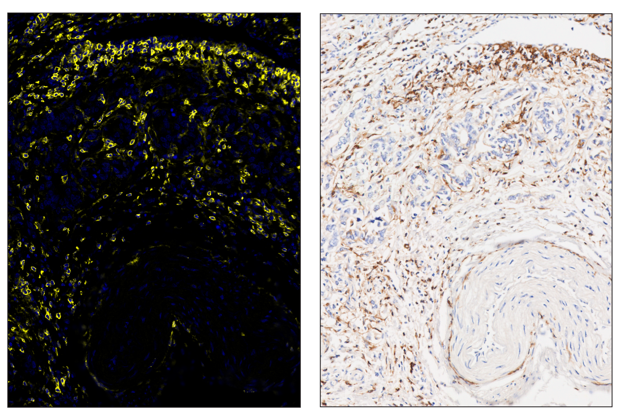 Immunohistochemistry Image 5: CD4 (MSVA-004R) & CO-0071-750 SignalStar™ Oligo-Antibody Pair