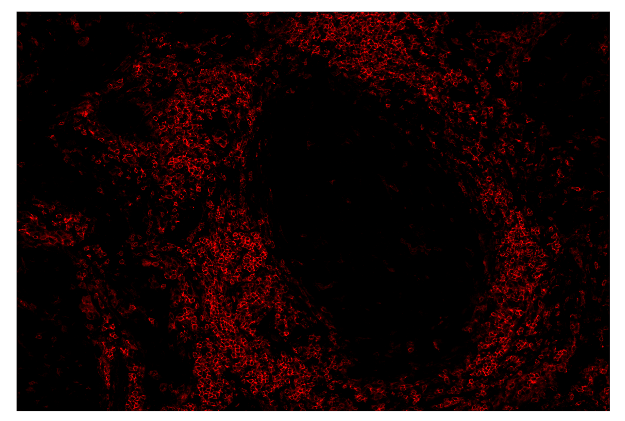 Immunohistochemistry Image 3: CD4 (MSVA-004R) & CO-0071-488 SignalStar™ Oligo-Antibody Pair