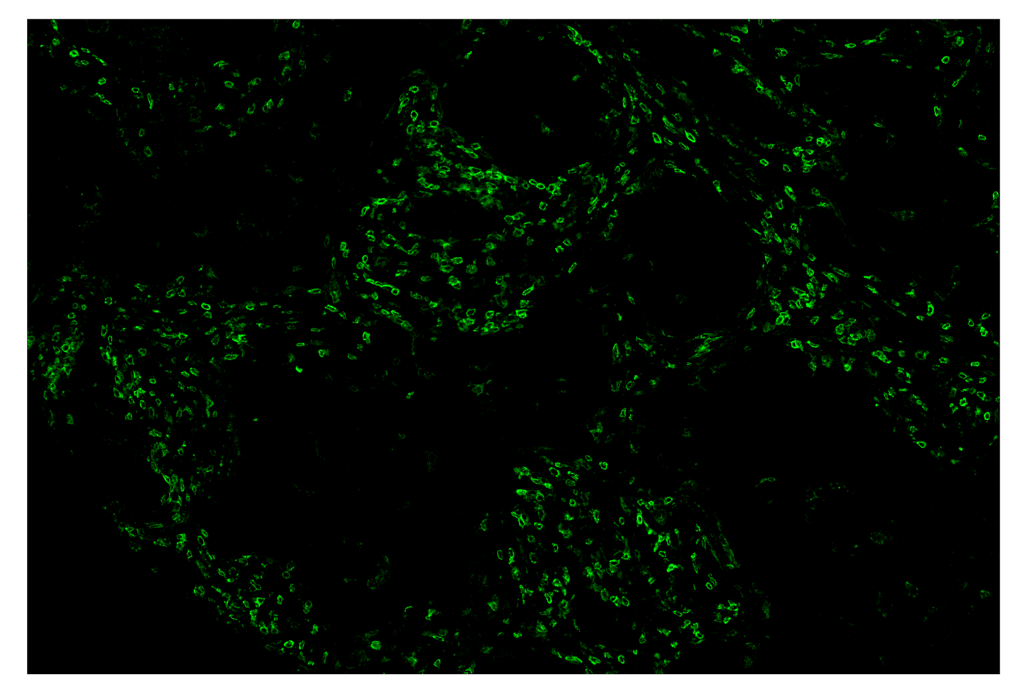 Immunohistochemistry Image 2: CD4 (MSVA-004R) & CO-0071-647 SignalStar™ Oligo-Antibody Pair