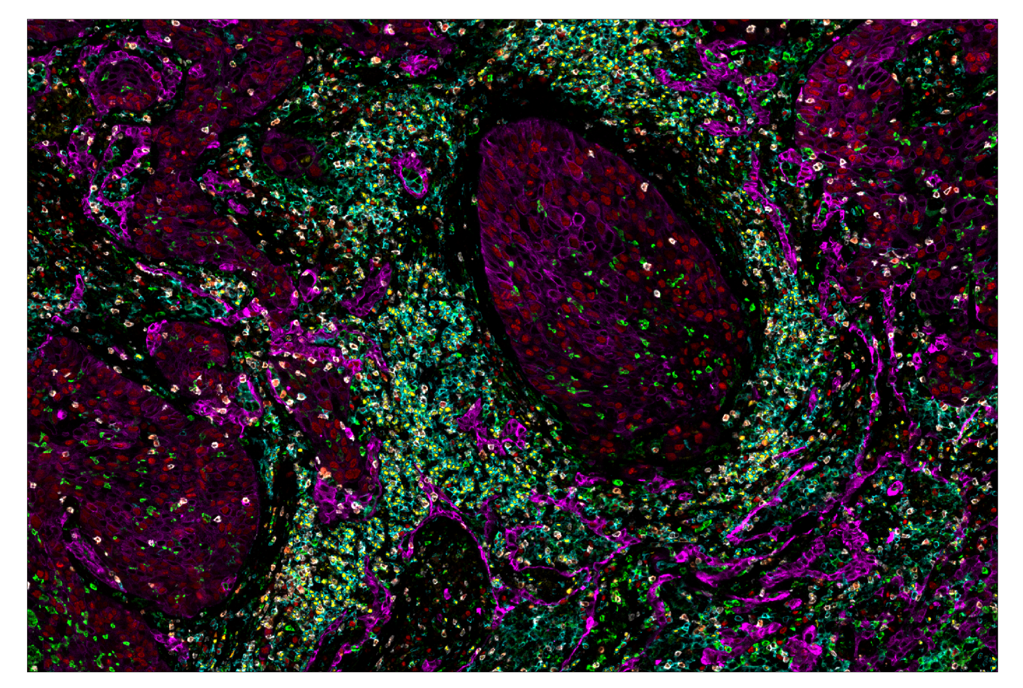 Immunohistochemistry Image 1: CD4 (MSVA-004R) & CO-0071-750 SignalStar™ Oligo-Antibody Pair