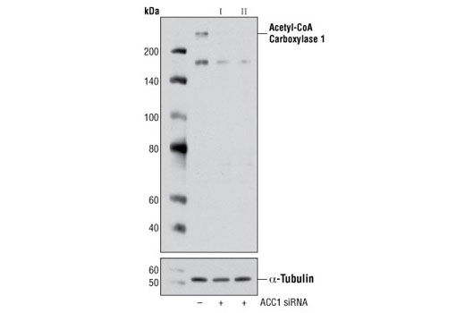  Image 1: SignalSilence® Acetyl-CoA Carboxylase 1 siRNA II
