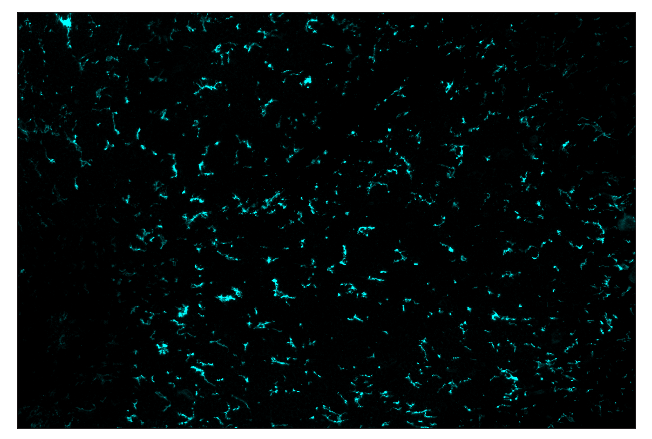 Immunohistochemistry Image 5: TMEM119 (E3E4T) & CO-00130-750 SignalStar™ Oligo-Antibody Pair