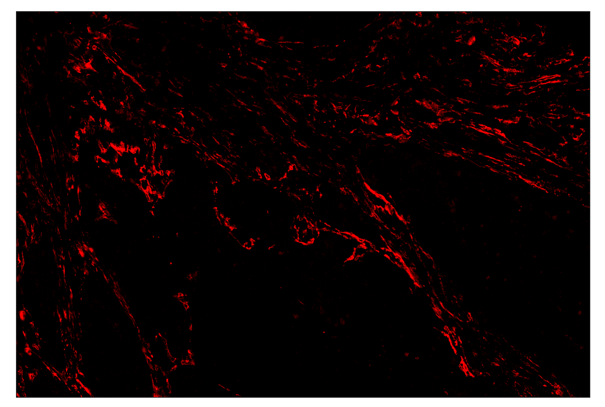 Immunohistochemistry Image 4: TMEM119 (E3E4T) & CO-00130-750 SignalStar™ Oligo-Antibody Pair