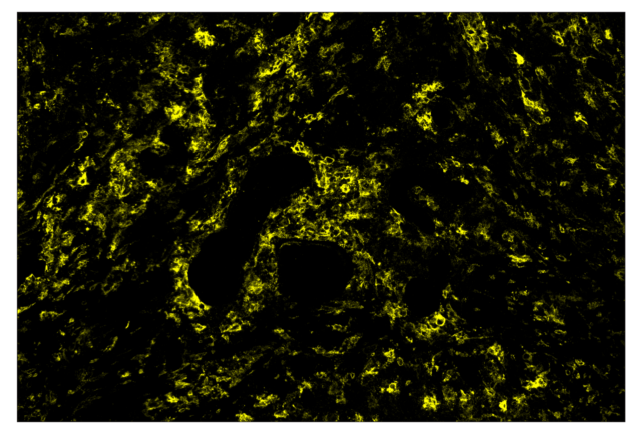 Immunohistochemistry Image 3: TMEM119 (E3E4T) & CO-00130-750 SignalStar™ Oligo-Antibody Pair