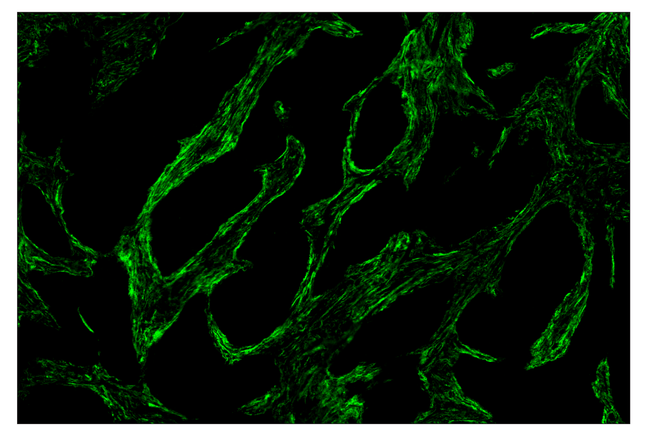 Immunohistochemistry Image 2: TMEM119 (E3E4T) & CO-00130-750 SignalStar™ Oligo-Antibody Pair