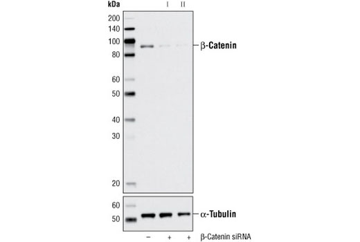  Image 1: SignalSilence® β-Catenin siRNA II