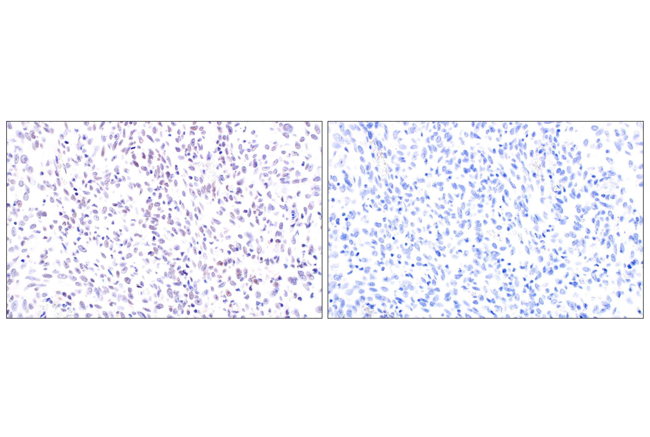 Immunohistochemistry Image 9: MDM2 (F7W7X) Rabbit mAb (BSA and Azide Free)
