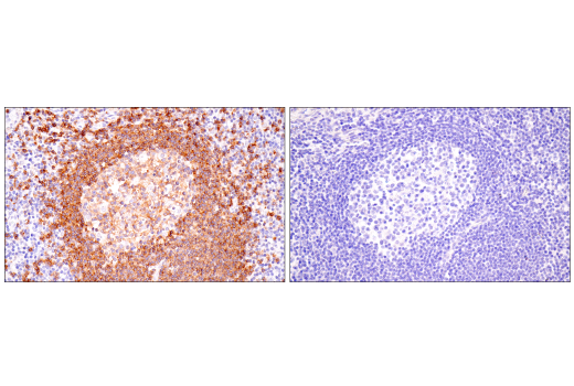 Immunohistochemistry Image 6: TNFRSF13C/BAFF-R (E3C1Q) XP® Rabbit mAb