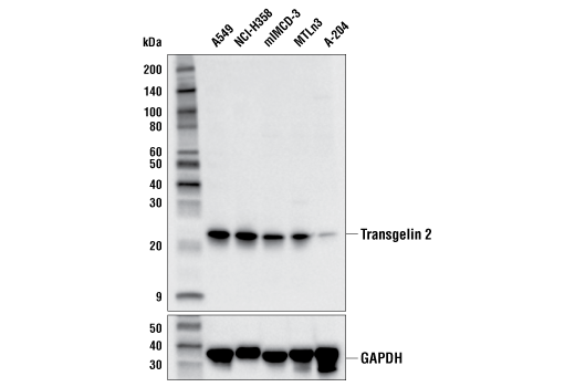 Western Blotting Image 1: Transgelin 2 (E3R3I) Rabbit mAb