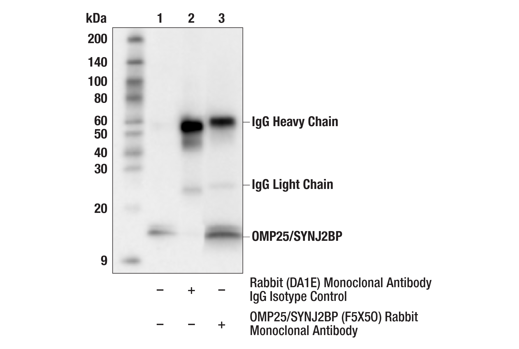 OMP25/SYNJ2BP: Mitochondria Marker