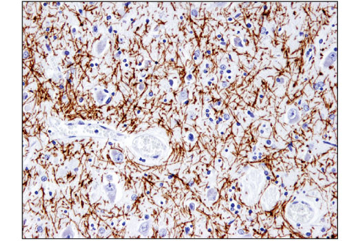 Immunohistochemistry Image 1: Myelin Basic Protein (D8X4Q) XP® Rabbit mAb (BSA and Azide Free)