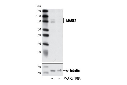  Image 1: SignalSilence® MARK2 siRNA I