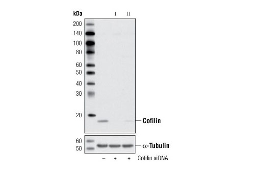  Image 1: SignalSilence® Cofilin siRNA I
