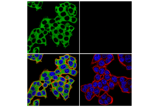 Immunofluorescence Image 1: KIF5B (E4A5A) Rabbit mAb