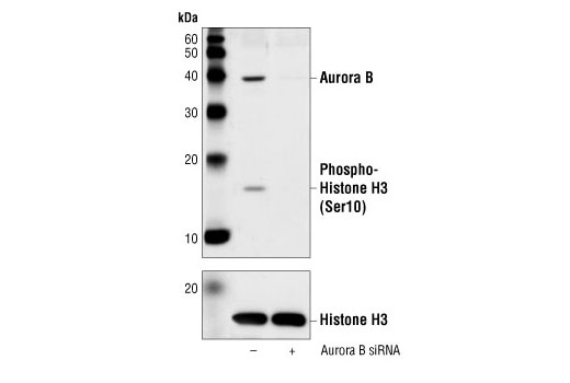  Image 2: SignalSilence® Aurora B siRNA (Human Specific)