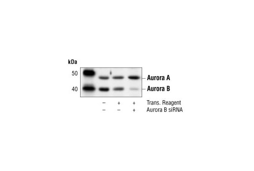  Image 3: SignalSilence® Aurora B siRNA (Human Specific)