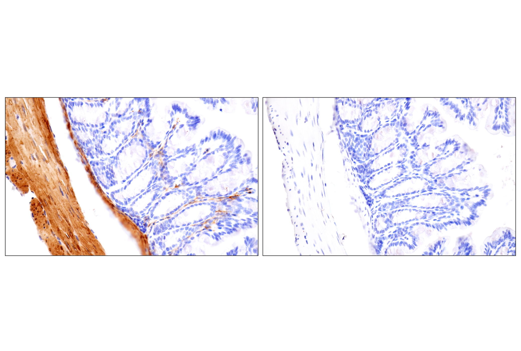 Immunohistochemistry Image 16: Desmin (F5V4I) Rabbit mAb (BSA and Azide Free)
