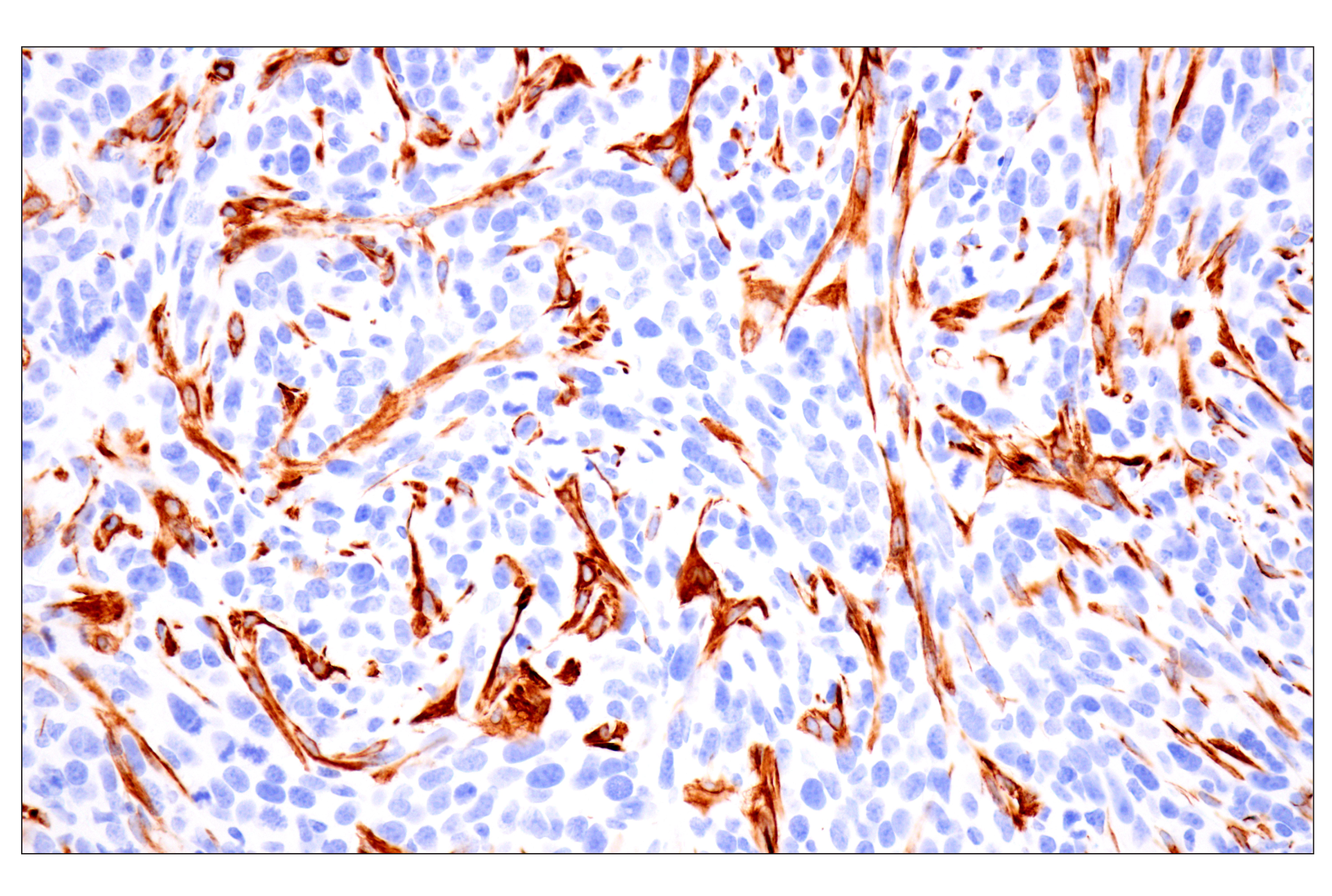 Immunohistochemistry Image 12: Desmin (F5V4I) Rabbit mAb (BSA and Azide Free)