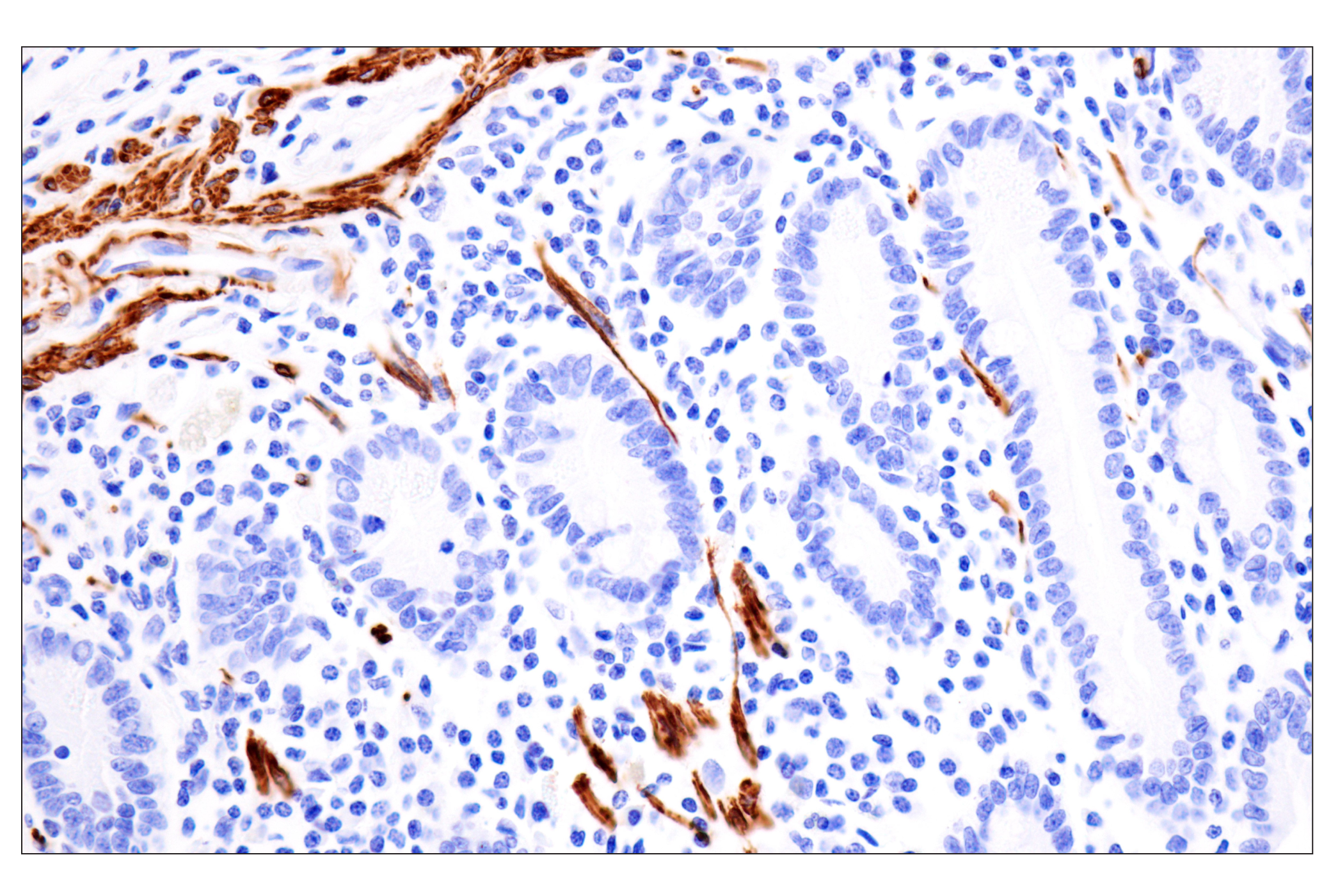 Immunohistochemistry Image 10: Desmin (F5V4I) Rabbit mAb (BSA and Azide Free)