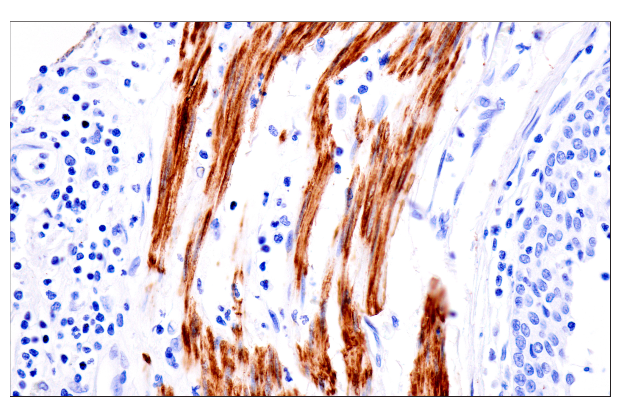 Immunohistochemistry Image 3: Desmin (F5V4I) Rabbit mAb (BSA and Azide Free)