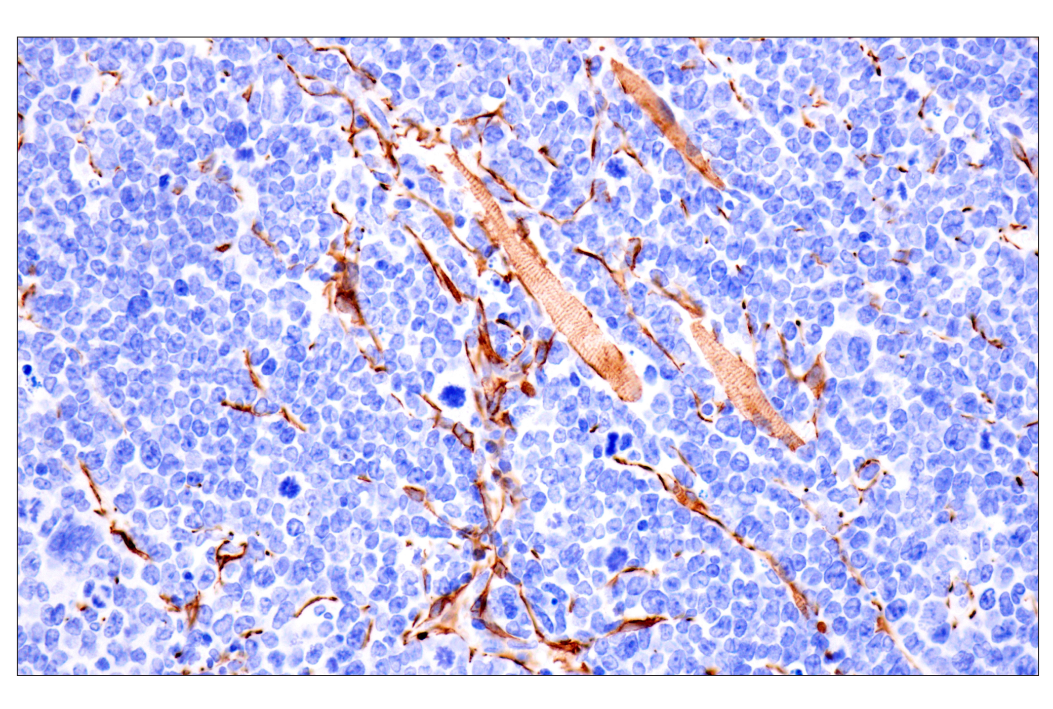 Immunohistochemistry Image 13: Desmin (F5V4I) Rabbit mAb (BSA and Azide Free)