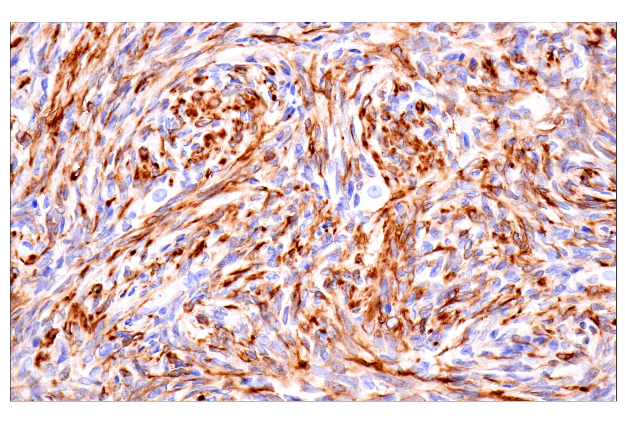 Immunohistochemistry Image 9: Desmin (F5V4I) Rabbit mAb (BSA and Azide Free)