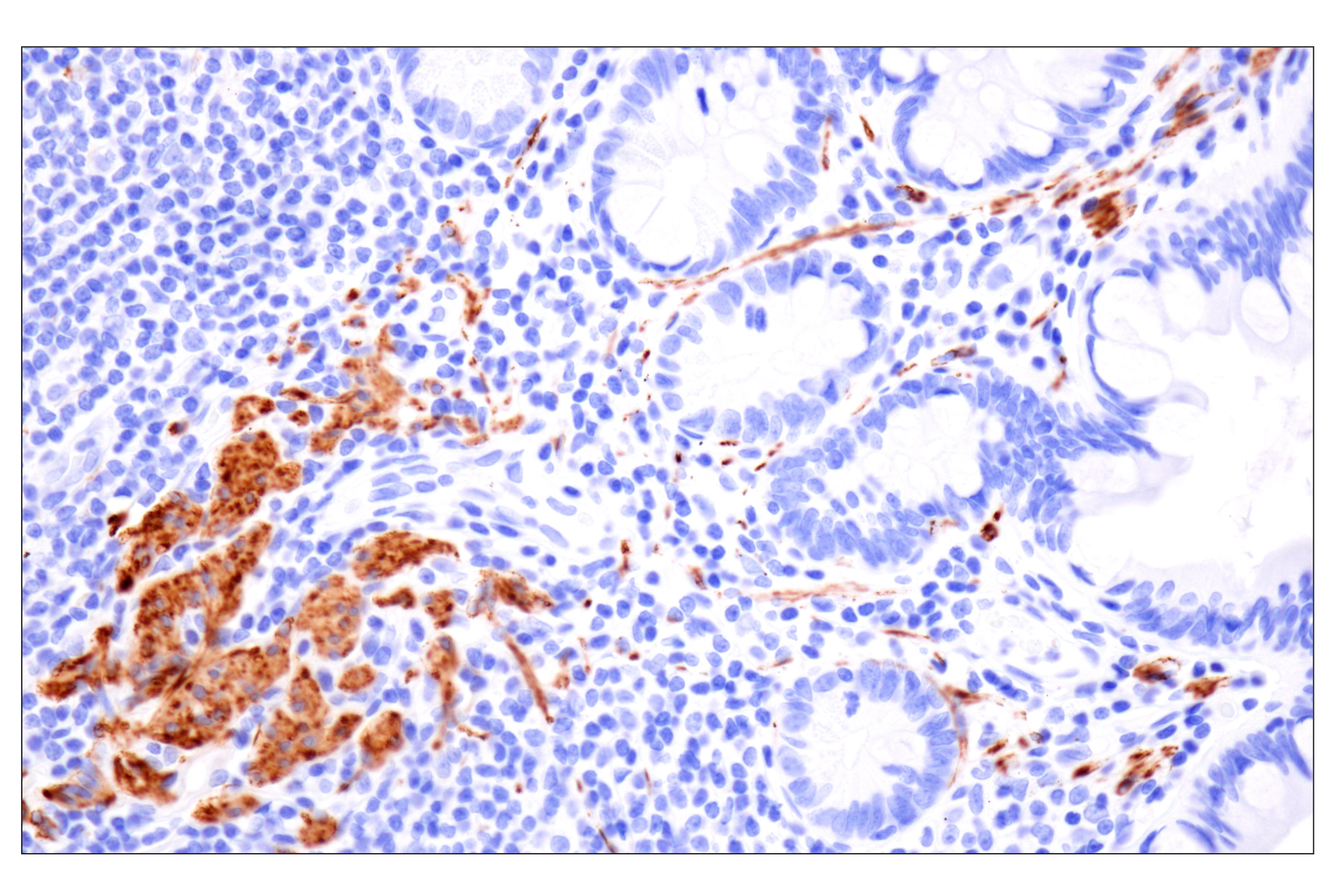 Immunohistochemistry Image 8: Desmin (F5V4I) Rabbit mAb (BSA and Azide Free)