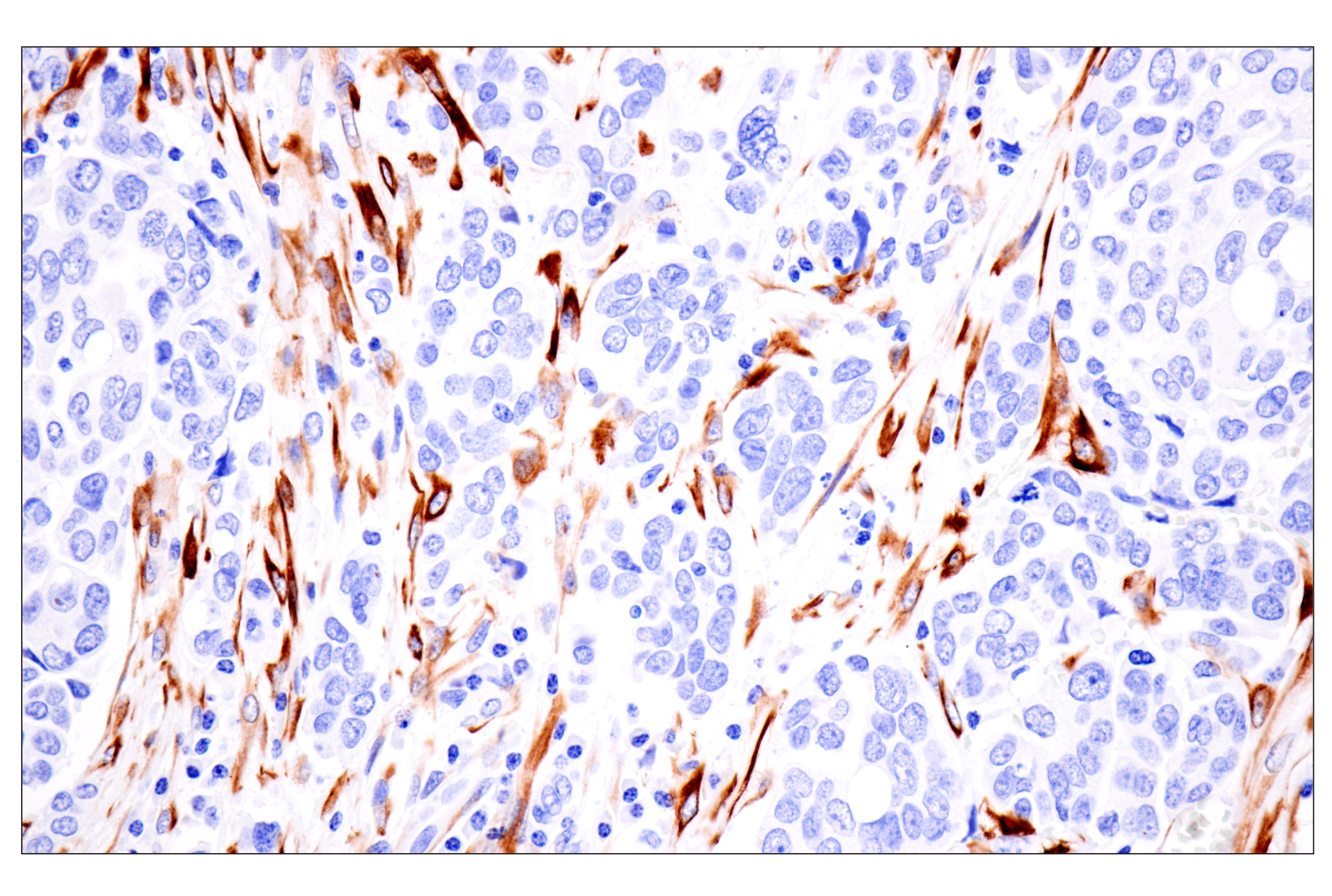 Immunohistochemistry Image 6: Desmin (F5V4I) Rabbit mAb (BSA and Azide Free)