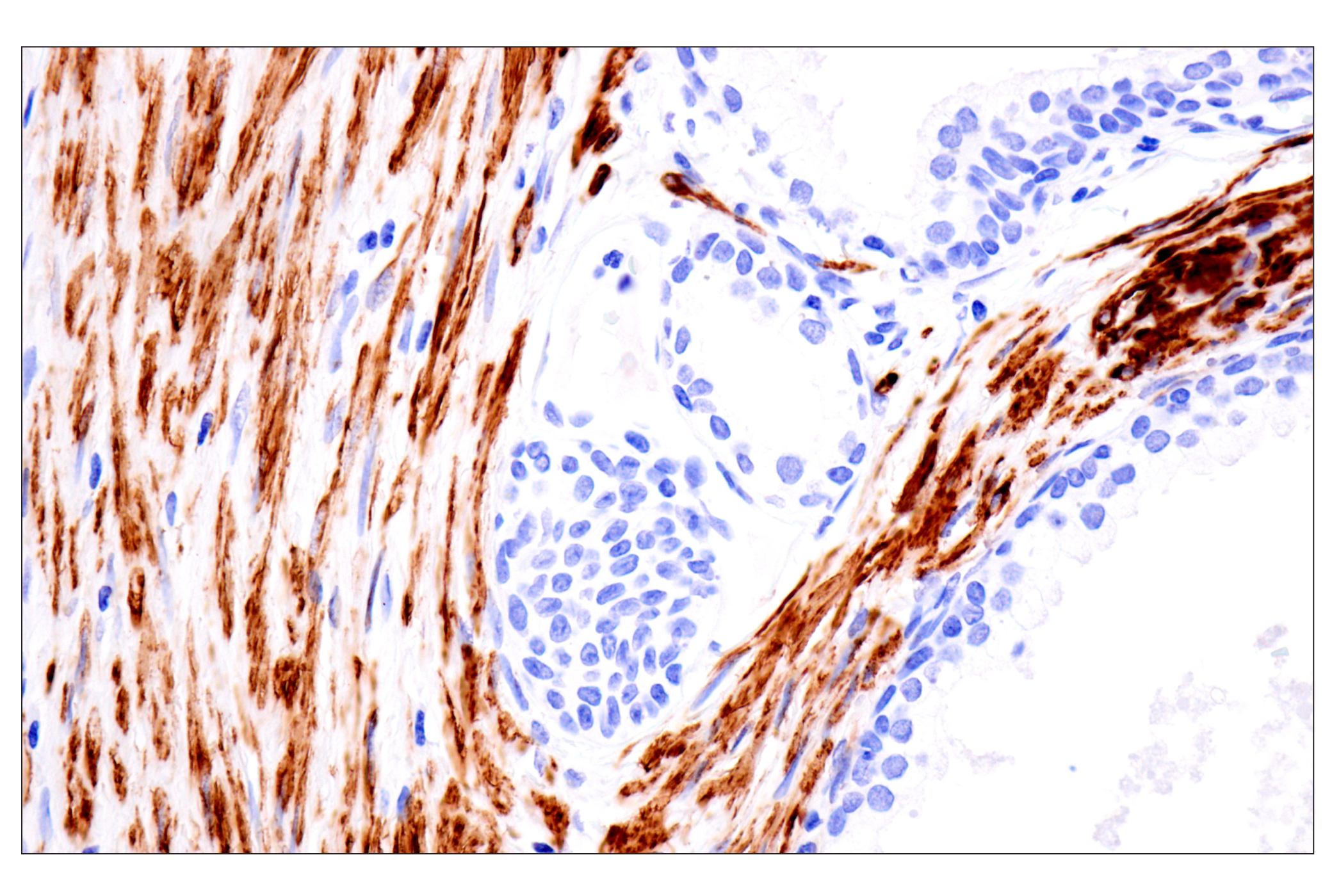 Immunohistochemistry Image 2: Desmin (F5V4I) Rabbit mAb (BSA and Azide Free)