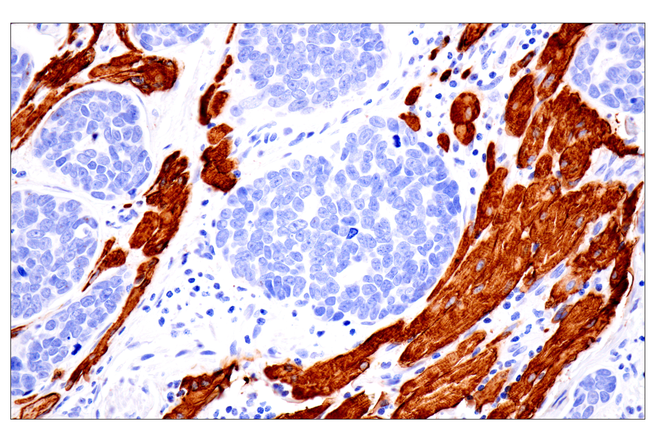 Immunohistochemistry Image 1: Desmin (F5V4I) Rabbit mAb (BSA and Azide Free)
