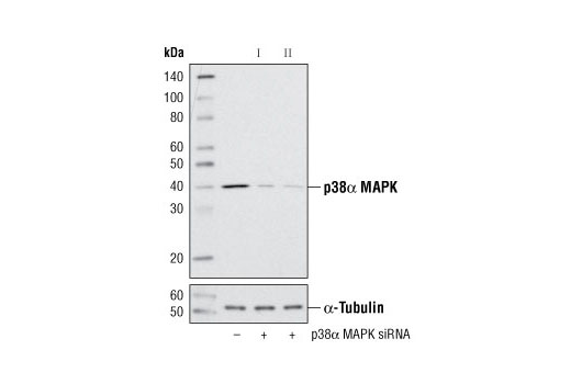  Image 1: SignalSilence® p38α MAPK siRNA II