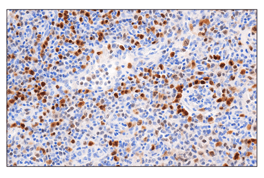 Immunohistochemistry Image 2: IRF-4 (E8H3S) XP® Rabbit mAb (BSA and Azide Free)