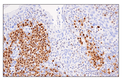 Immunohistochemistry Image 7: IRF-4 (E8H3S) XP® Rabbit mAb (BSA and Azide Free)