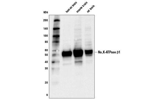 Western Blotting Image 1: Na,K-ATPase β1 (D8W8J) Rabbit mAb