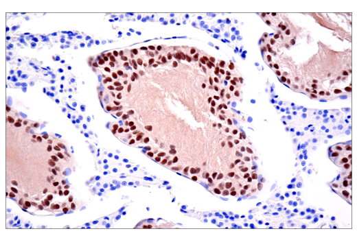 Immunohistochemistry Image 6: Tox/Tox2 (E6I3Q) Rabbit mAb (BSA and Azide Free)