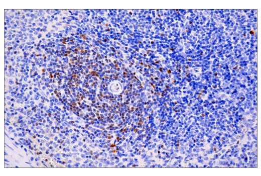 Immunohistochemistry Image 4: Tox/Tox2 (E6I3Q) Rabbit mAb (BSA and Azide Free)