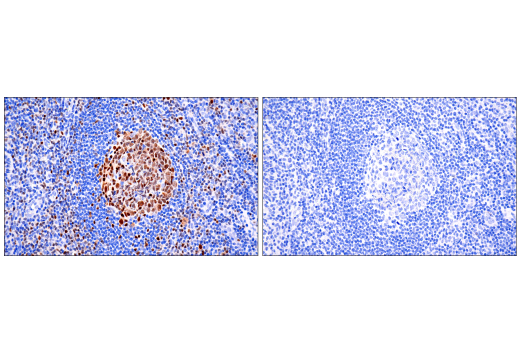 Immunohistochemistry Image 2: Tox/Tox2 (E6I3Q) Rabbit mAb (BSA and Azide Free)