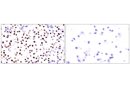 Immunohistochemistry Image 7: Tox/Tox2 (E6I3Q) Rabbit mAb (BSA and Azide Free)