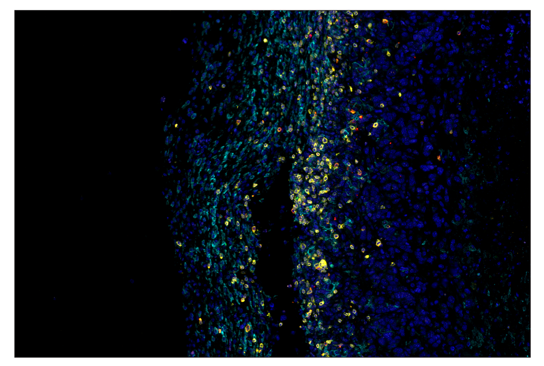 Immunohistochemistry Image 7: CD3ε (E4T1B) & CO-0048-488 SignalStar™ Oligo-Antibody Pair