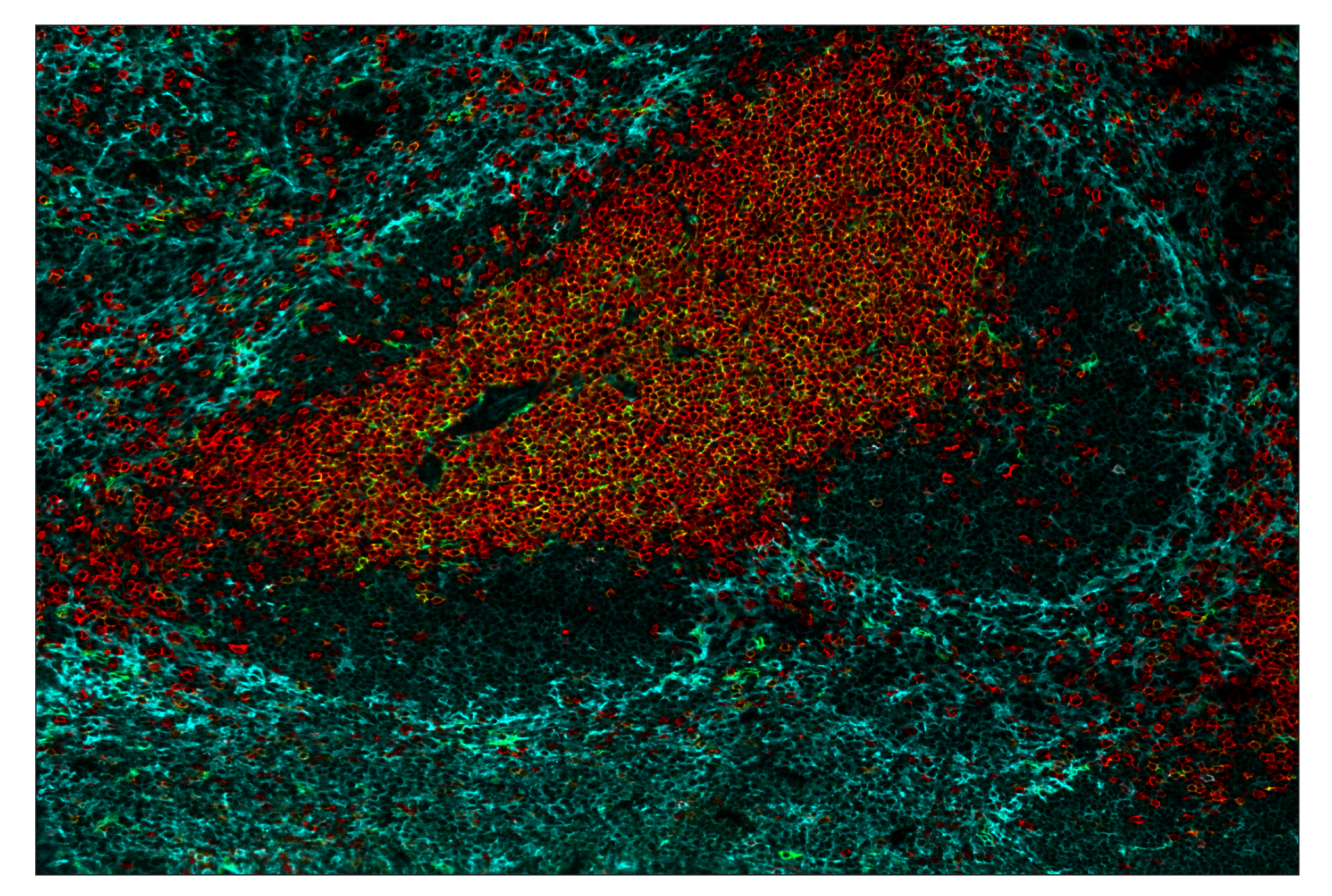 Immunohistochemistry Image 8: CD3ε (E4T1B) & CO-0048-488 SignalStar™ Oligo-Antibody Pair