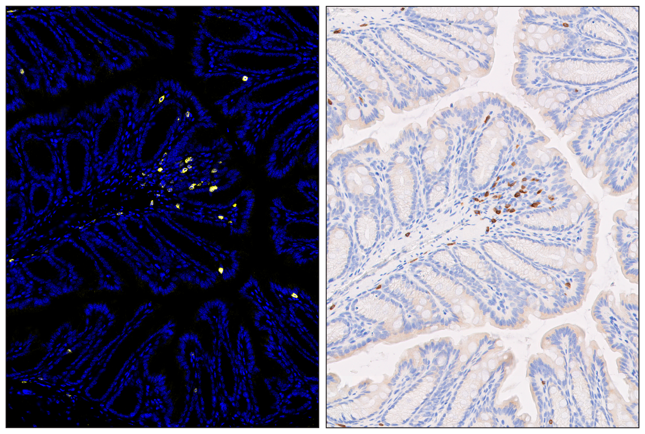 Immunohistochemistry Image 6: CD3ε (E4T1B) & CO-0048-594 SignalStar™ Oligo-Antibody Pair