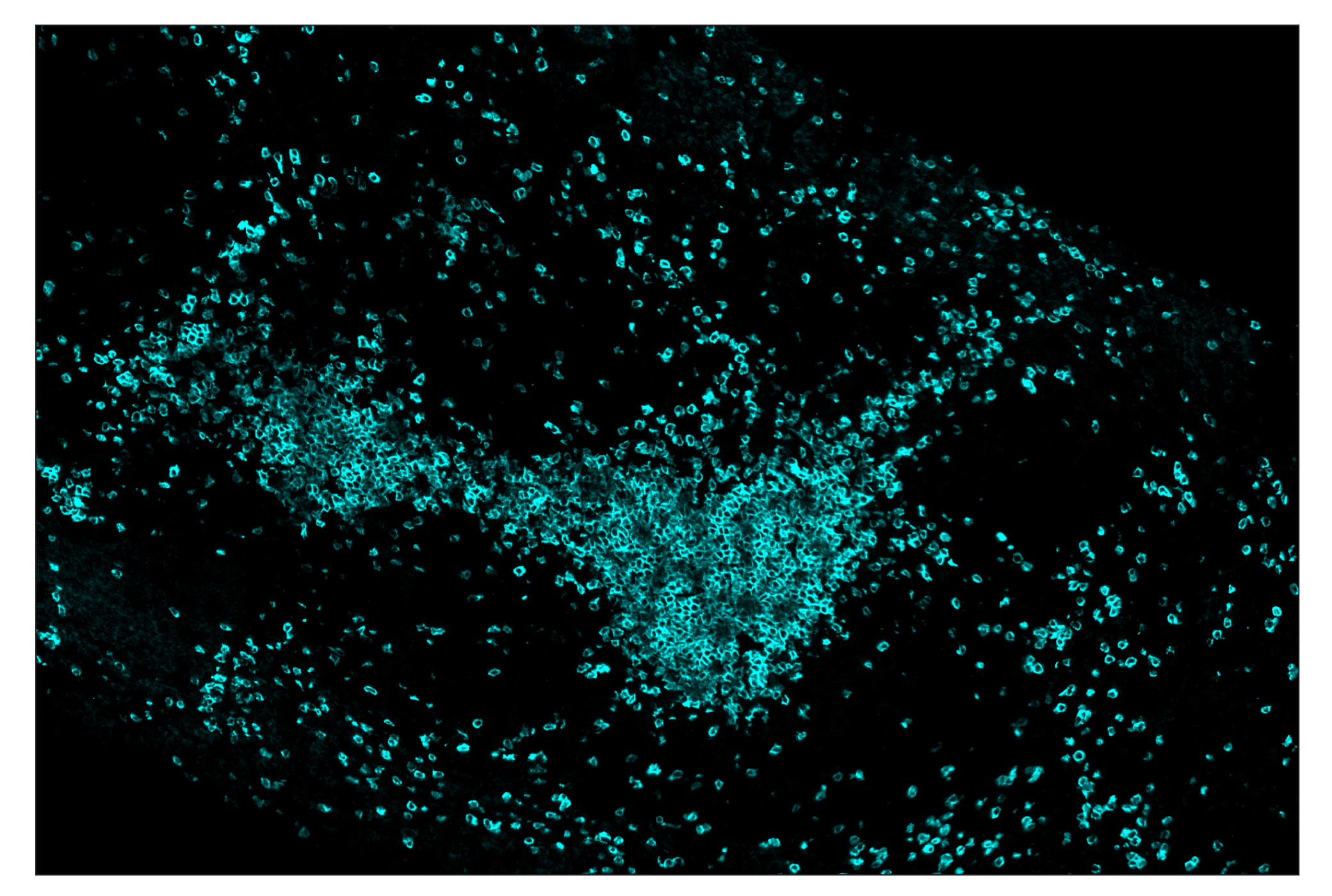 Immunohistochemistry Image 5: CD3ε (E4T1B) & CO-0048-488 SignalStar™ Oligo-Antibody Pair