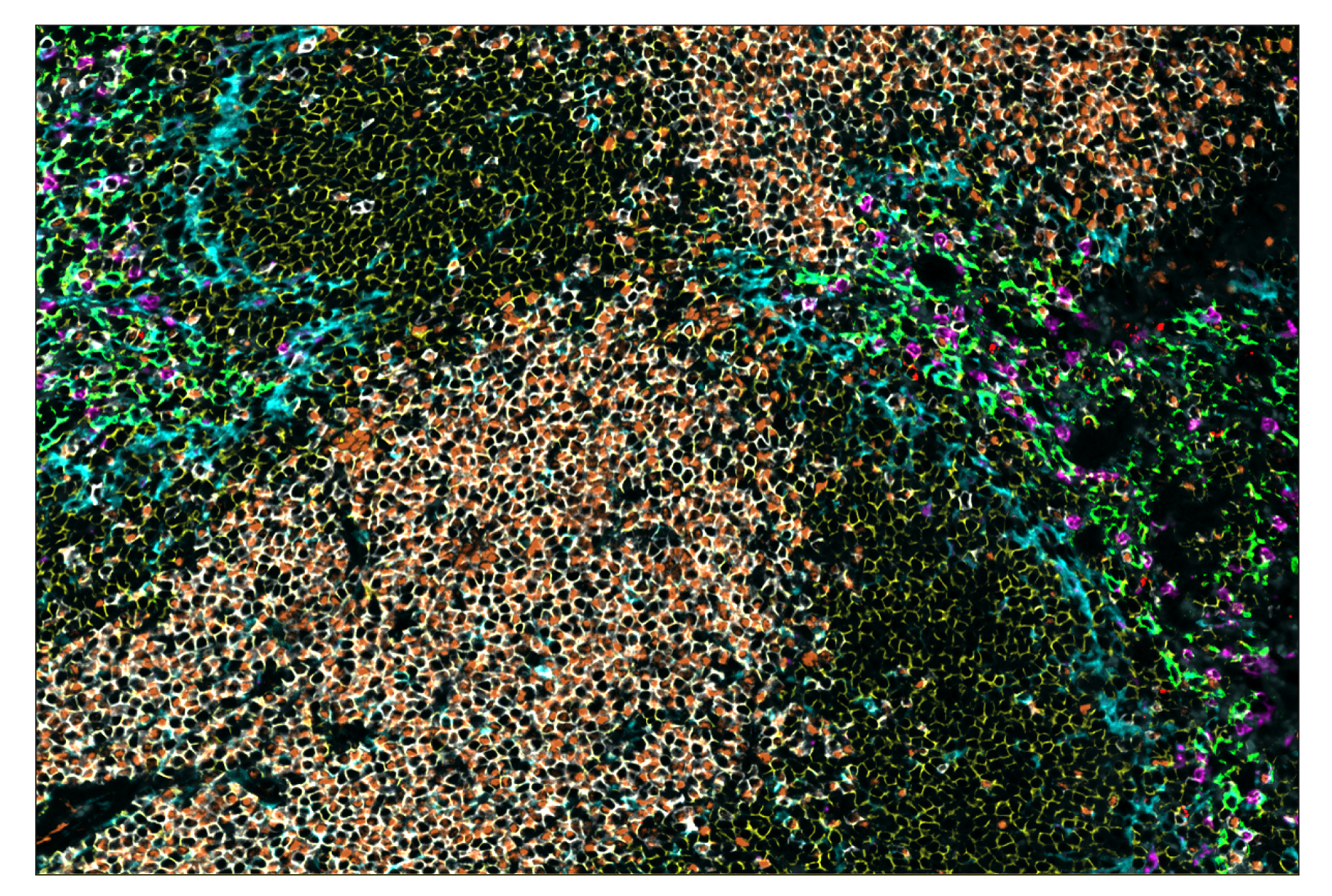 Immunohistochemistry Image 1: CD3ε (E4T1B) & CO-0048-750 SignalStar™ Oligo-Antibody Pair