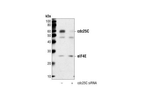  Image 2: SignalSilence® cdc25C siRNA (Human Specific)